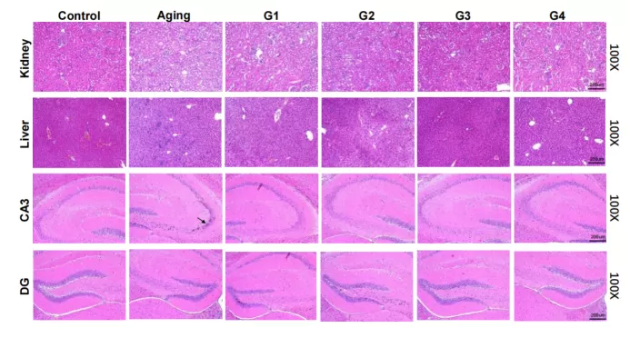 Resultados convincentes en el modelo de envejecimiento natural