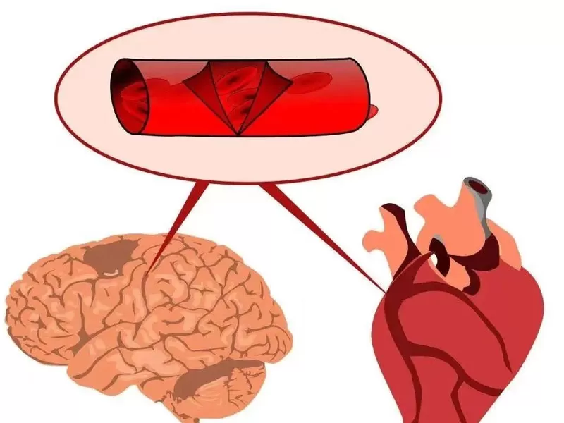 Serie Anti-Envejecimiento: Resveratrol