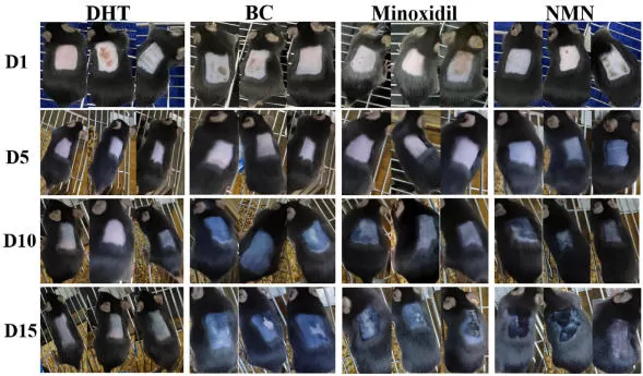 NMN y crecimiento del cabello: nueva evidencia en la Alopecia Androgenética (AGA)